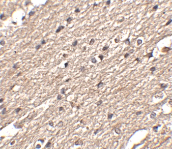 SPRED3 Antibody