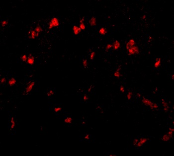 Spred1 Antibody
