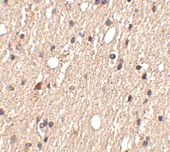 Spred1 Antibody