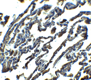 SPNS1 Antibody