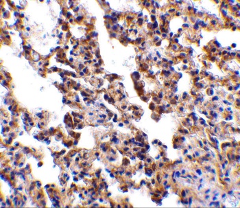 IL21R Antibody