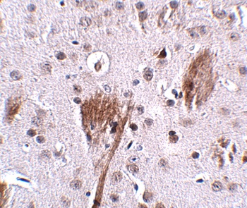 SPG11 Antibody