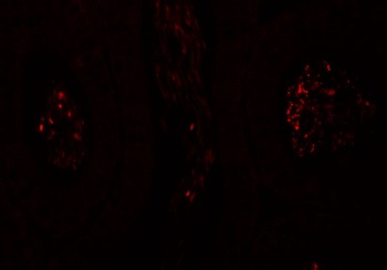 SPATA1 Antibody