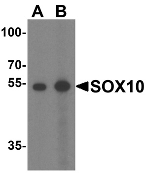 SOX10 Antibody