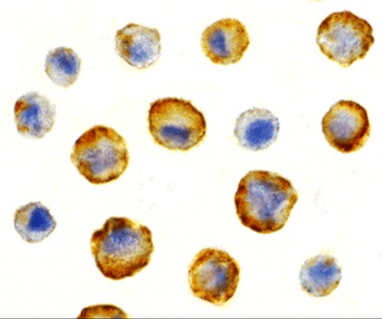 SODD Antibody