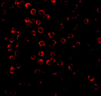 SODD Antibody