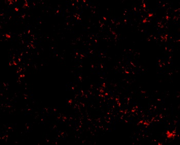 SnoN Antibody