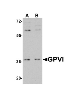 GPVI Antibody