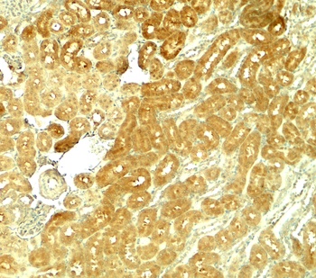 SMURF1 Antibody