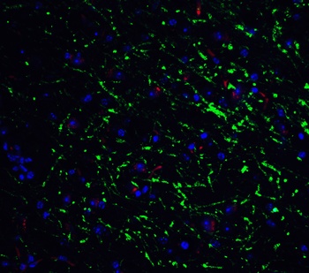 GABARAP Antibody