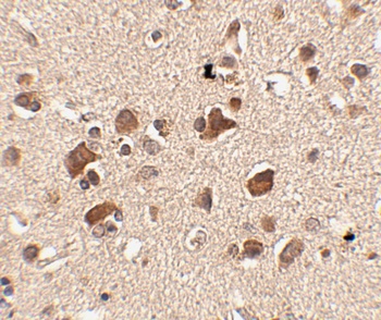 Slitrk6 Antibody