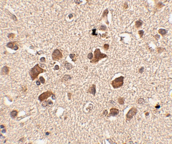 SLITRK6 Antibody