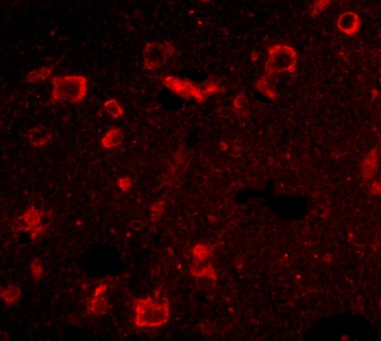 SLITRK6 Antibody