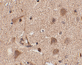 SLITRK5 Antibody