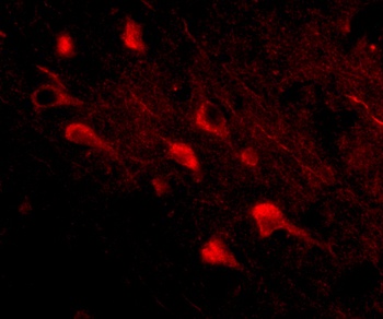 SLITRK5 Antibody