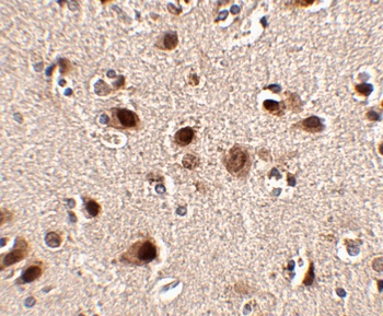 SLITRK5 Antibody