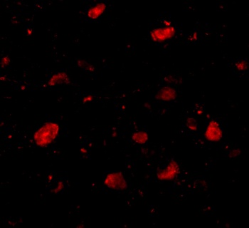 Slitrk5 Antibody