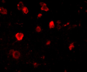 SLITRK4 Antibody