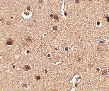 Slitrk4 Antibody