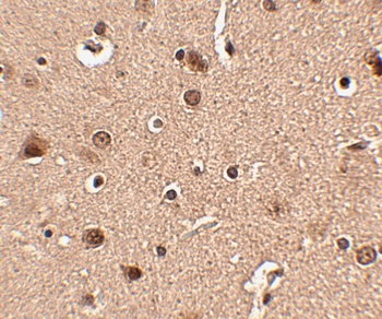 SLITRK4 Antibody