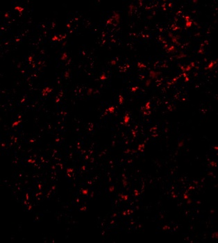 FEM1B Antibody