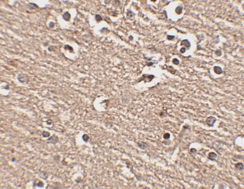 Slitrk1 Antibody
