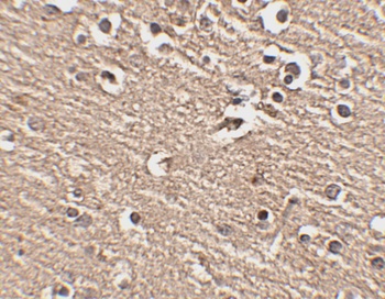 SLITRK1 Antibody