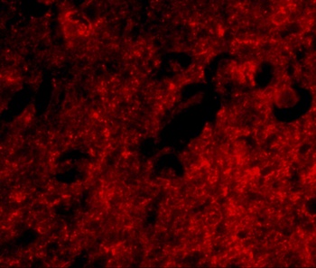 Slitrk1 Antibody