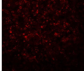 SLFN14 Antibody