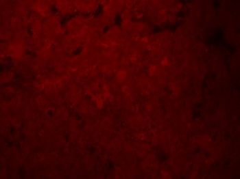 SLCO1B1 Antibody