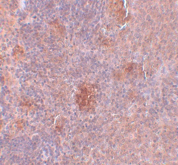 SLC37A2 Antibody