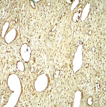 SLC29A1 Antibody