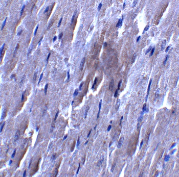 SLC27A6 Antibody