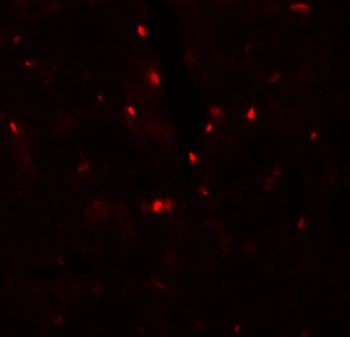 SLC27A6 Antibody