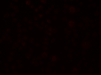 SLAIN1 Antibody