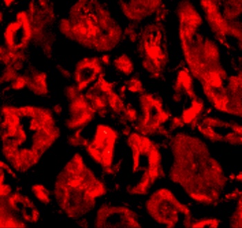 SkiP Antibody