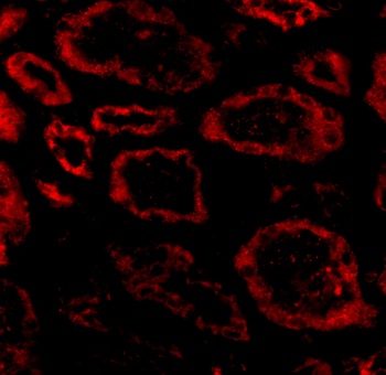 Ski Antibody