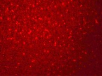 SIVA Antibody