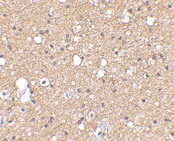 SIRT2 Antibody