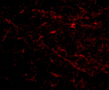 SIRT2 Antibody