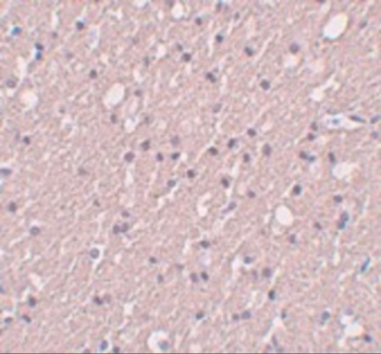 SIPA1L3 Antibody