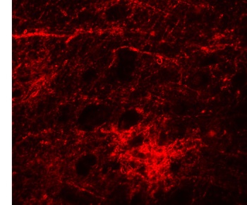 SIPA1L3 Antibody