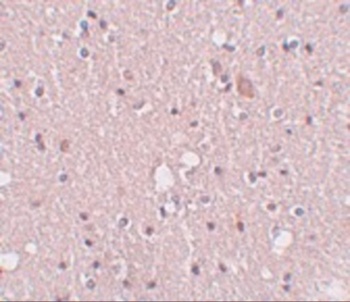 SIPA1L2 Antibody