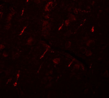 SIPA1L2 Antibody