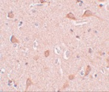 SIPA1L1 Antibody