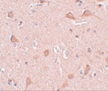 SIPA1L1 Antibody