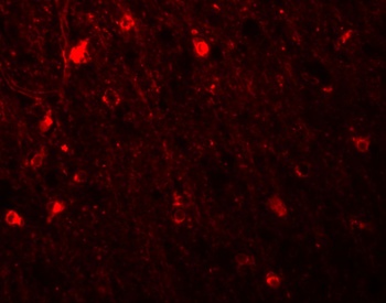 SIPA1L1 Antibody