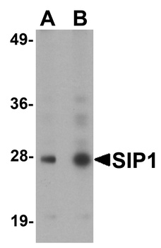 GEMIN2 Antibody
