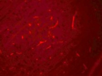 SIK3 Antibody