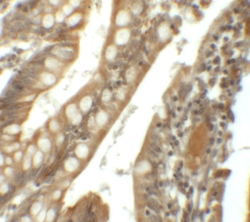 SIK1 Antibody